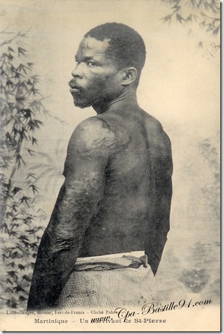 Martinique-Un-survivant-de-St-Pierre-éditeur-Leboullanger